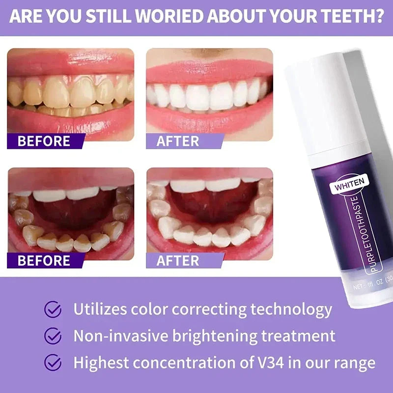 V34 Teeth Whitening Toothpaste 5D