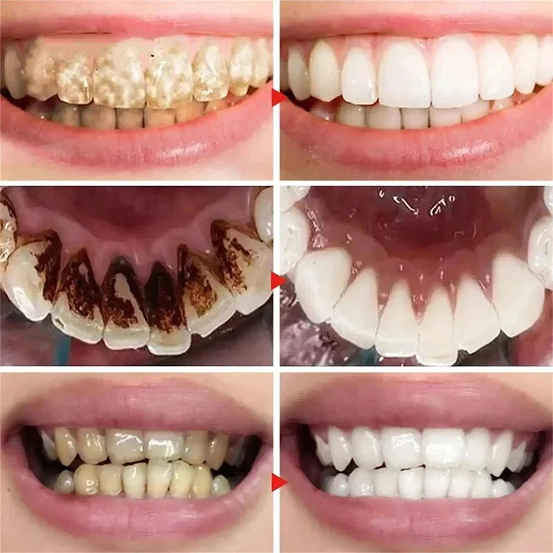 V34 Teeth Whitening Toothpaste 5D