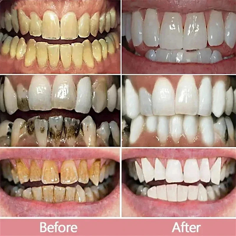 V34 Teeth Whitening Toothpaste 5D