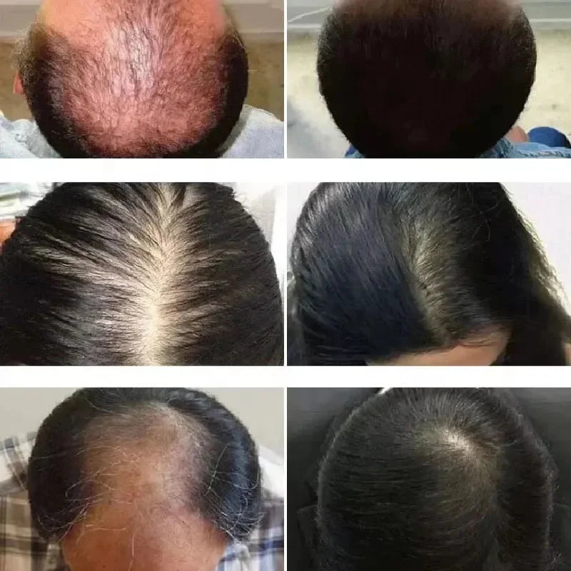 Rosemary Hair Growth  50ml